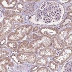 Immunohistochemical staining of human kidney shows moderate cytoplasmic positivity in cells in tubules.