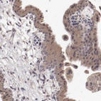 Immunohistochemical staining of human placenta shows moderate cytoplasmic positivity in trophoblastic cells.