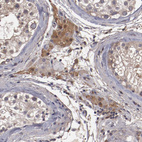 Immunohistochemical staining of human testis shows moderate cytoplasmic positivity in Leydig cells.