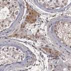 Immunohistochemical staining of human testis shows moderate cytoplasmic positivity in Leydig cells.