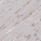 Immunohistochemical staining of human skeletal muscle shows no positivity in myocytes as expected.