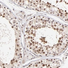 Immunohistochemical staining of human testis shows moderate nuclear cytoplasmic positivity in cells in seminiferous ducts.