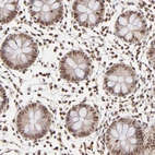 Immunohistochemical staining of human colon shows strong nuclear positivity in lymphoid cells and cytoplasmic-nucleus positivity in glandular cells.
