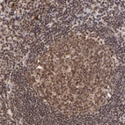 Immunohistochemical staining of human tonsil tissues shows moderate nuclear cytoplasmic positivity in germinal center cells and non-germinal center cells.