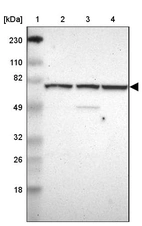 Lane 1: Marker [kDa] 230, 110, 82, 49, 32, 26, 18_br/_Lane 2: Human cell line RT-4_br/_Lane 3: Human cell line U-251MG sp_br/_Lane 4: Human plasma (IgG/HSA depleted)