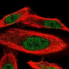 Immunofluorescent staining of human cell line PC-3 shows localization to nucleoplasm.