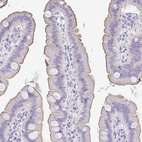 Immunohistochemical staining of human small intestine shows moderate membranous positivity in glandular cells.