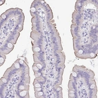 Immunohistochemical staining of human small intestine shows moderate membranous positivity in glandular cells.