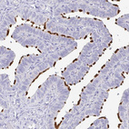Immunohistochemical staining of human fallopian tube shows strong positivity in cilia.