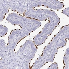 Immunohistochemical staining of human fallopian tube shows strong positivity in cilia.