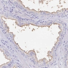 Immunohistochemical staining of human prostate shows moderate membranous positivity in glandular cells.