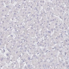 Immunohistochemical staining of human liver shows no positivity in hepatocytes as expected.
