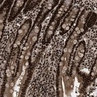 Immunohistochemical staining of human duodenum shows strong nuclear-cytoplasmic positivity in glandular cells and lymphoid cells.