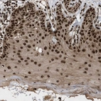 Immunohistochemical staining of human skin shows strong nuclear-cytoplasmic positivity in squamous epithelial cells.