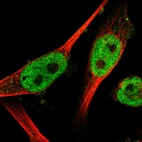Immunofluorescent staining of human cell line U-251 MG shows localization to nucleoplasm.
