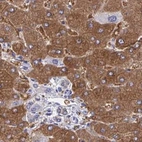 Immunohistochemical staining of human liver using Anti-HGD antibody HPA052359.
