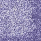 Immunohistochemical staining of human tonsil using Anti-HGD antibody HPA052359.