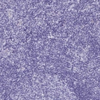 Immunohistochemical staining of human tonsil shows no positivity in non-germinal center cells as expected.