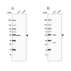 Western blot analysis using Anti-HGD antibody HPA052359 (A) shows similar pattern to independent antibody HPA047374 (B).