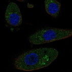 Immunofluorescent staining of human cell line RPTEC TERT1 shows localization to the Golgi apparatus.