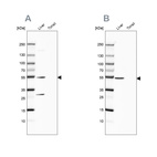 Western blot analysis using Anti-HGD antibody HPA047374 (A) shows similar pattern to independent antibody HPA052359 (B).