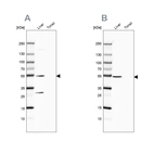 Western blot analysis using Anti-HGD antibody HPA047374 (A) shows similar pattern to independent antibody HPA052359 (B).
