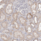 Immunohistochemical staining of human kidney shows moderate cytoplasmic and membranous positivity in cells in tubules.