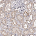 Immunohistochemical staining of human kidney shows moderate cytoplasmic and membranous positivity in cells in tubules.