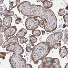 Immunohistochemical staining of human placenta shows moderate cytoplasmic and membranous positivity in trophoblastic cells.