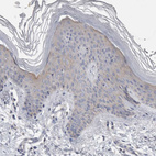 Immunohistochemical staining of human skin shows weak cytoplasmic positivity in squamous epithelial cells.