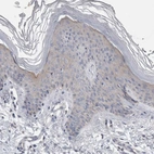 Immunohistochemical staining of human skin shows weak cytoplasmic positivity in squamous epithelial cells.