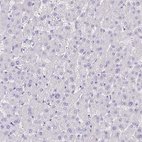 Immunohistochemical staining of human liver shows no positivity in hepatocytes as expected.