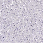Immunohistochemical staining of human liver shows no positivity in hepatocytes as expected.