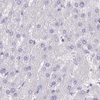 Immunohistochemical staining of human liver using Anti-SPERT antibody HPA040046.