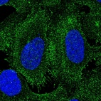 Immunofluorescent staining of human cell line U-2 OS shows localization to plasma membrane.