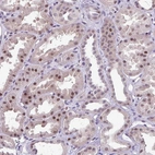 Immunohistochemical staining of human kidney shows moderate nuclear positivity in cells in tubules with weak cytoplasmic positivity.