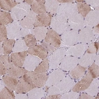 Immunohistochemical staining of human skeletal muscle shows moderate nuclear positivity in myocytes with moderate cytoplasmic positivity in subset of cells.