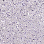 Immunohistochemical staining of human liver shows no positivity in hepatocytes as expected.