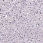 Immunohistochemical staining of human liver shows no positivity in hepatocytes as expected.