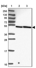 Lane 1: Marker [kDa] 250, 130, 95, 72, 55, 36, 28, 17, 10_br/_Lane 2: Human cell line RT-4_br/_Lane 3: Human cell line U-251MG sp