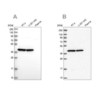 Western blot analysis using Anti-MRPS9 antibody HPA043476 (A) shows similar pattern to independent antibody HPA048479 (B).