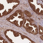 Immunohistochemical staining of human prostate shows strong cytoplasmic positivity in glandular cells.