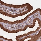 Immunohistochemical staining of human fallopian tube shows strong cytoplasmic positivity in glandular cells.