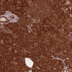 Immunohistochemical staining of human pancreas shows strong cytoplasmic positivity in exocrine glandular cells.