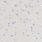 Anti-LCK Antibody