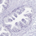 Immunohistochemical staining of human prostate shows no positivity in glandular cells as expected.