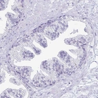 Immunohistochemical staining of human prostate shows no positivity in glandular cells as expected.