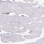 Immunohistochemical staining of human skeletal muscle shows no positivity in myocytes as expected.