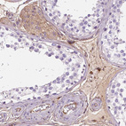 Immunohistochemical staining of human testis shows moderate cytoplasmic positivity in Leydig cells.
