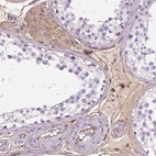Immunohistochemical staining of human testis shows moderate cytoplasmic positivity in Leydig cells.